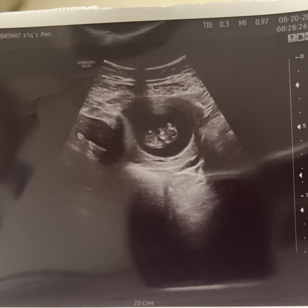 Photo shared by Marissa for their Babylist baby registry.