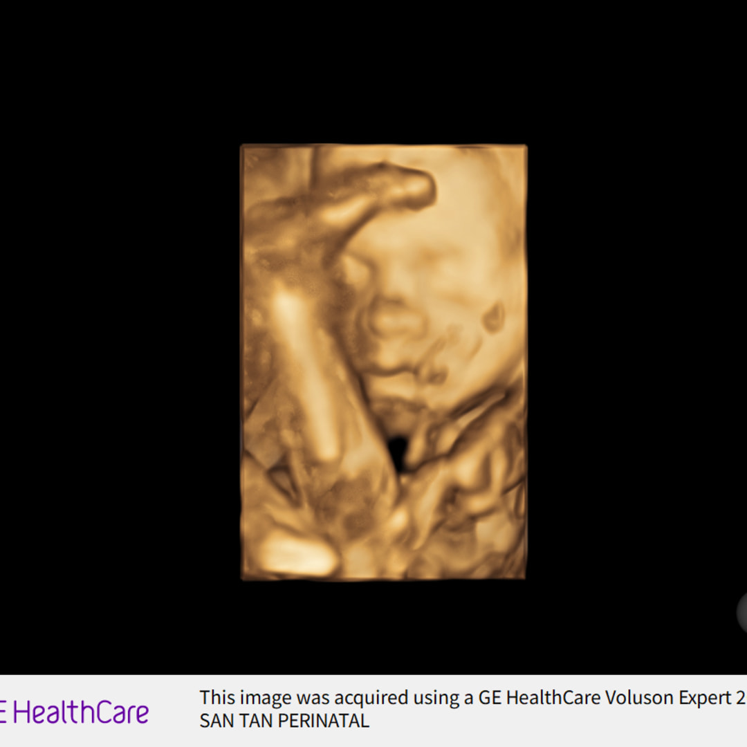Photo shared by Leah for their Babylist baby registry.