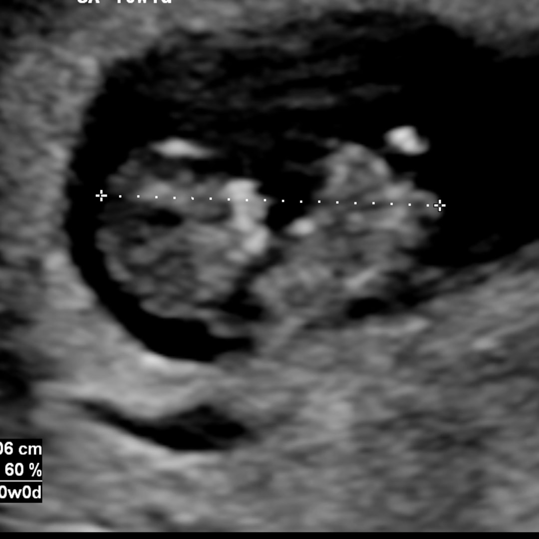 Photo shared by Kelsey for their Babylist baby registry.