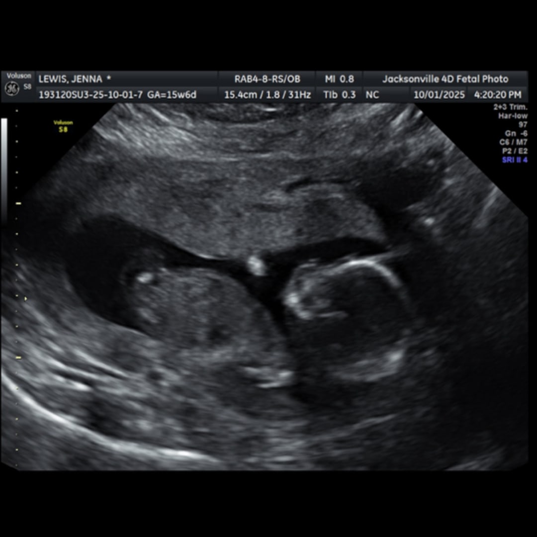 Photo shared by Jenna for their Babylist baby registry.