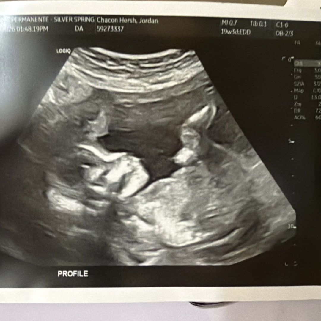 Photo shared by Jordan for their Babylist baby registry.