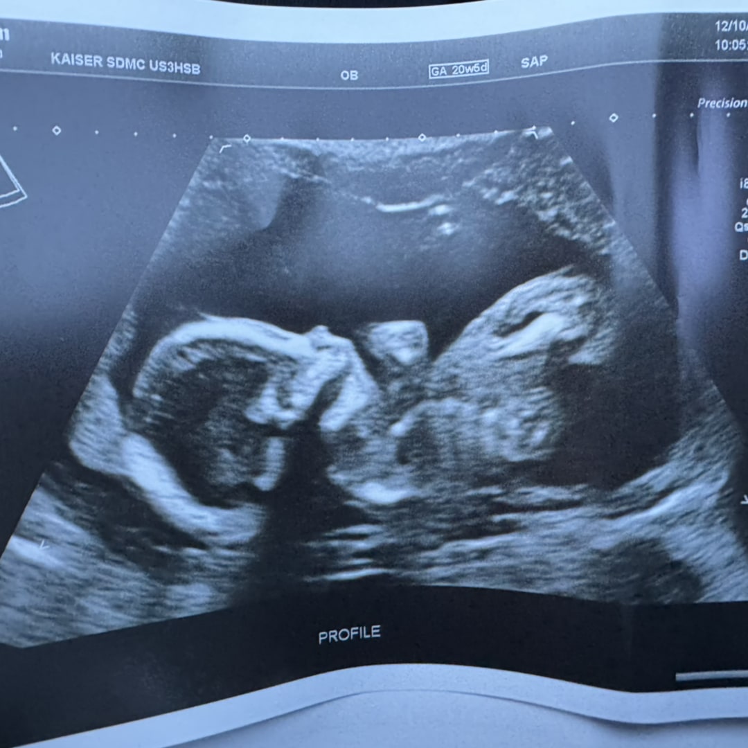 Photo shared by Isabel for their Babylist baby registry.