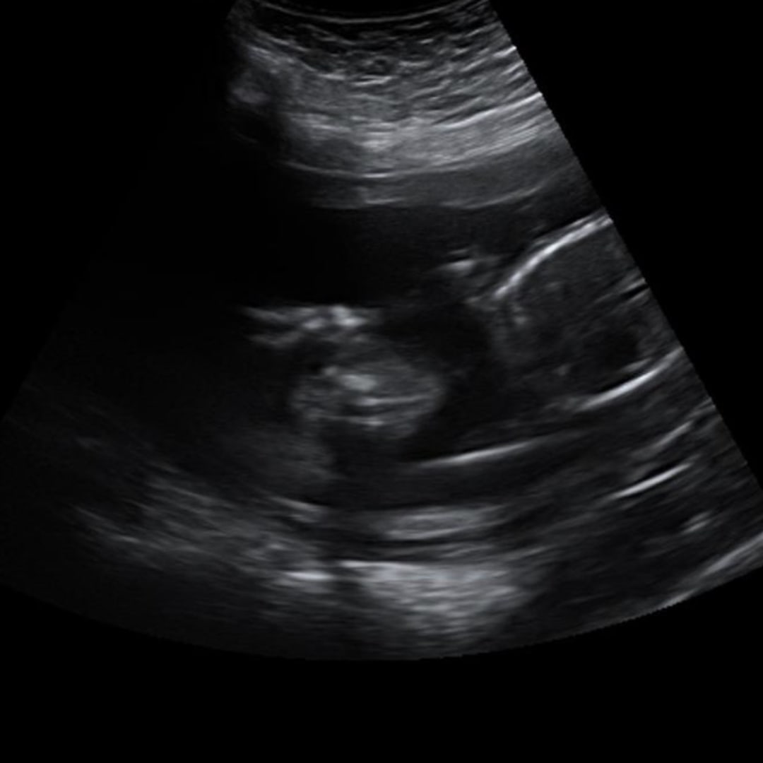 Photo shared by Brianna for their Babylist baby registry.