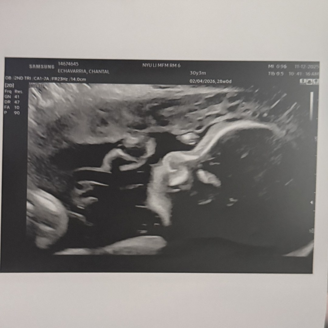 Photo shared by Chantal for their Babylist baby registry.