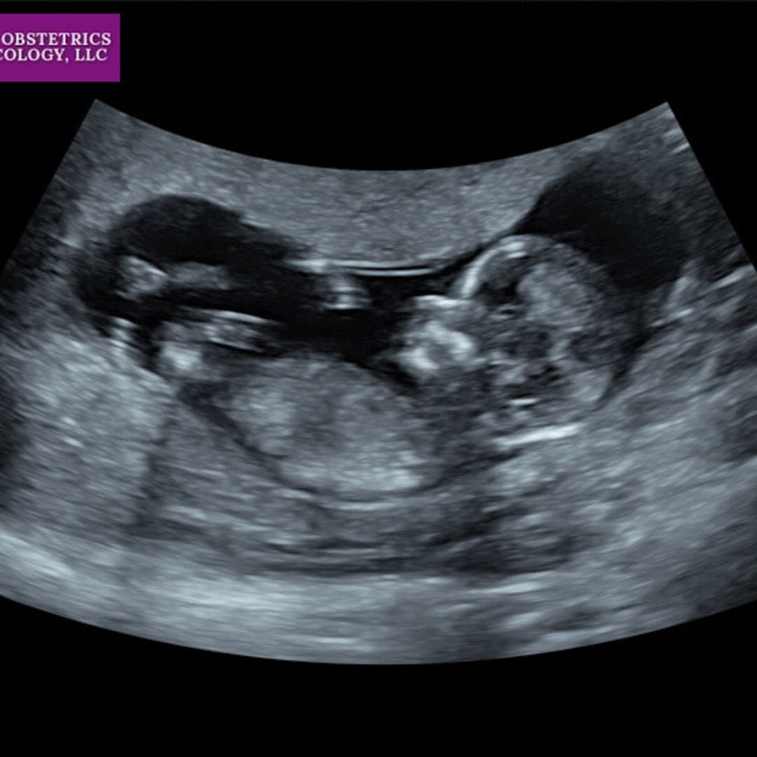 Photo shared by Debora for their Babylist baby registry.
