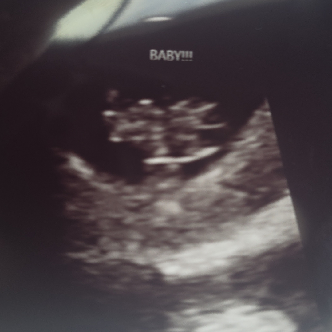 Photo shared by Makaila for their Babylist baby registry.