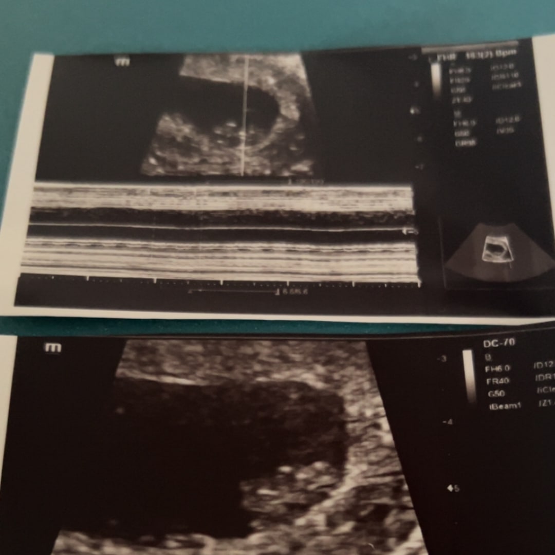 Photo shared by Gabrielle for their Babylist baby registry.