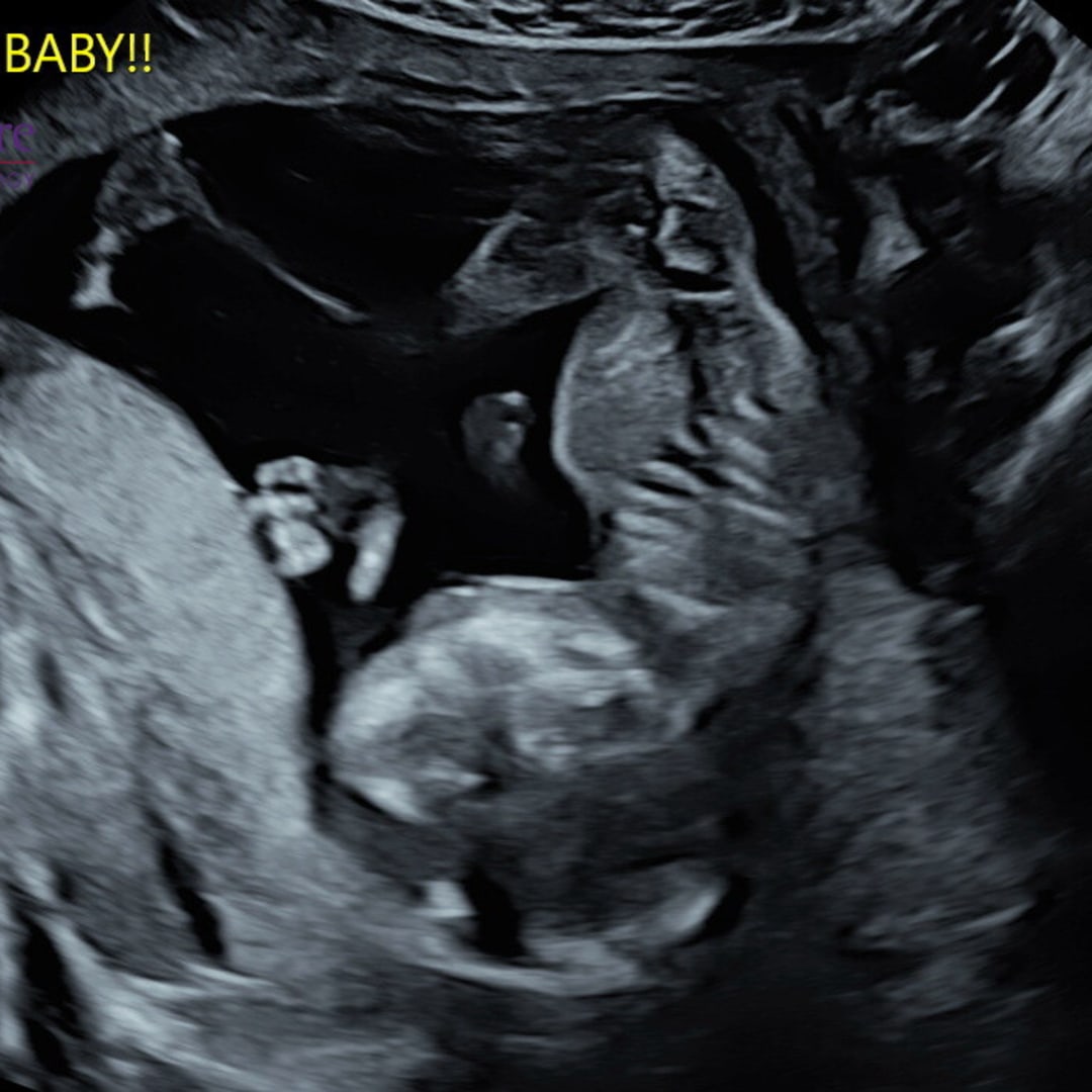 Photo shared by Jacie for their Babylist baby registry.