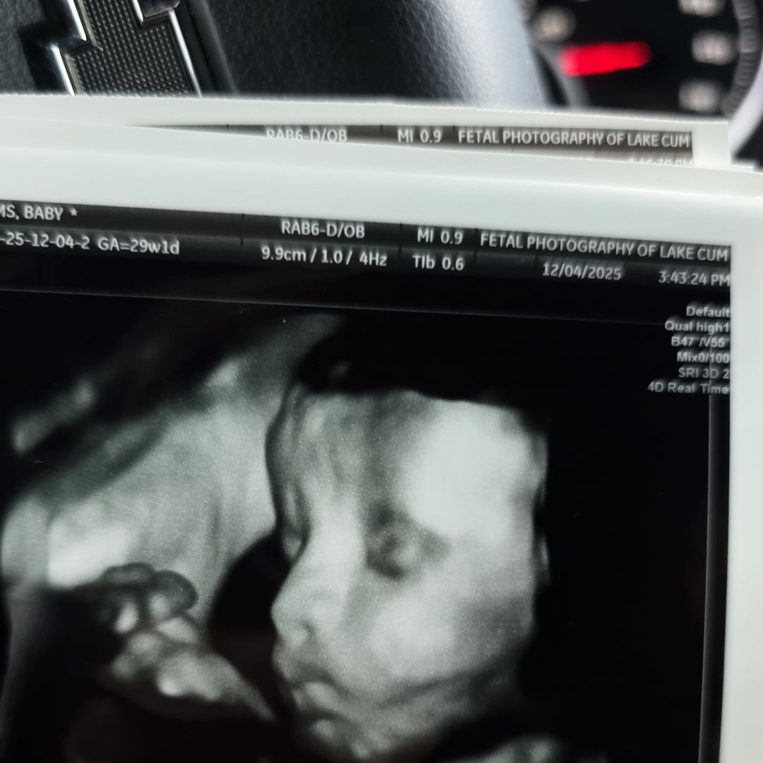 Photo shared by Aqualyn for their Babylist baby registry.