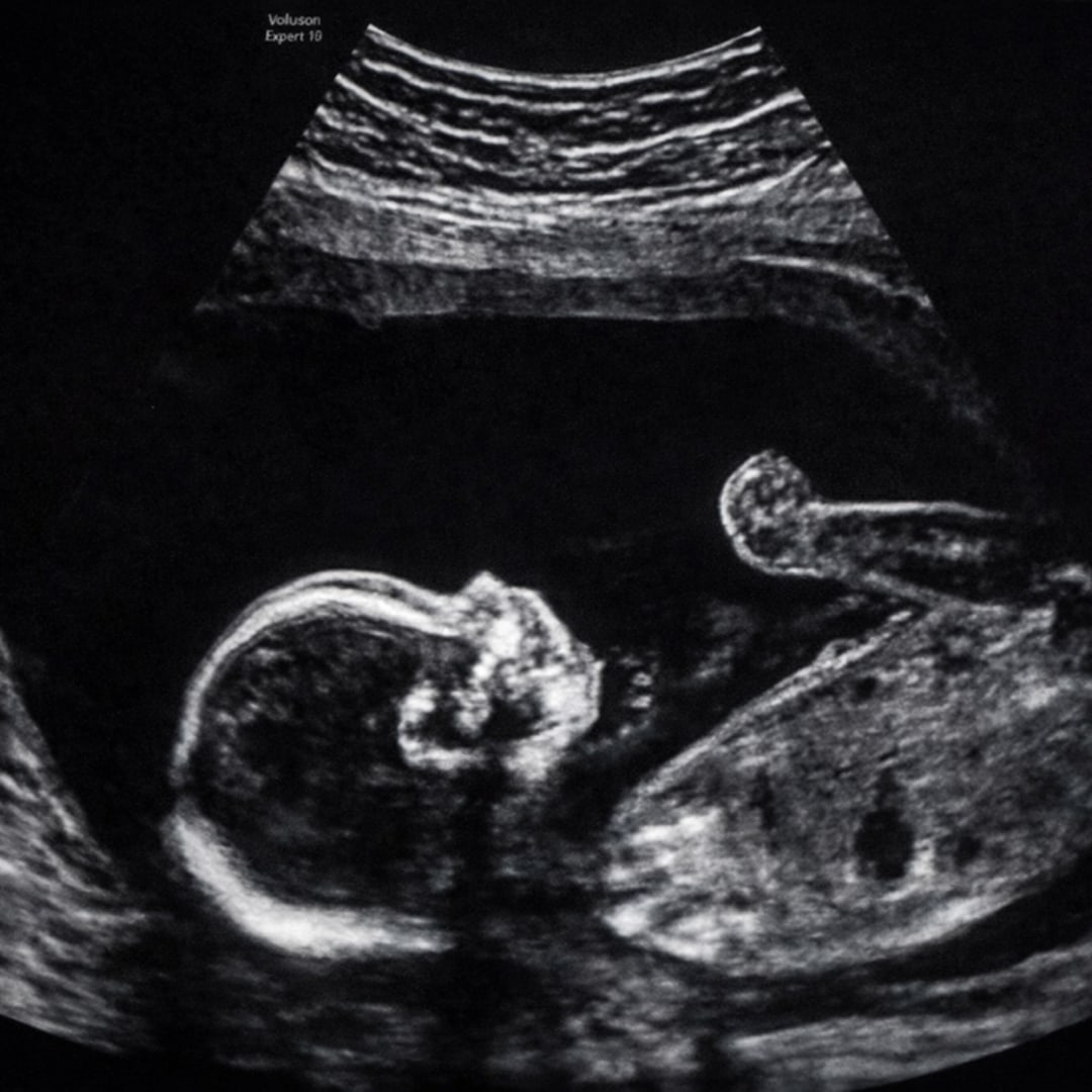 Photo shared by Clowee for their Babylist baby registry.