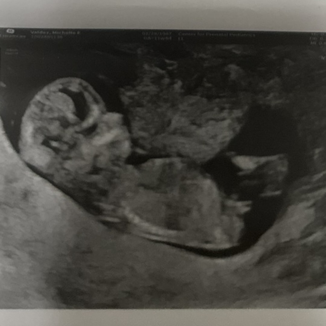 Photo shared by Michelle for their Babylist baby registry.