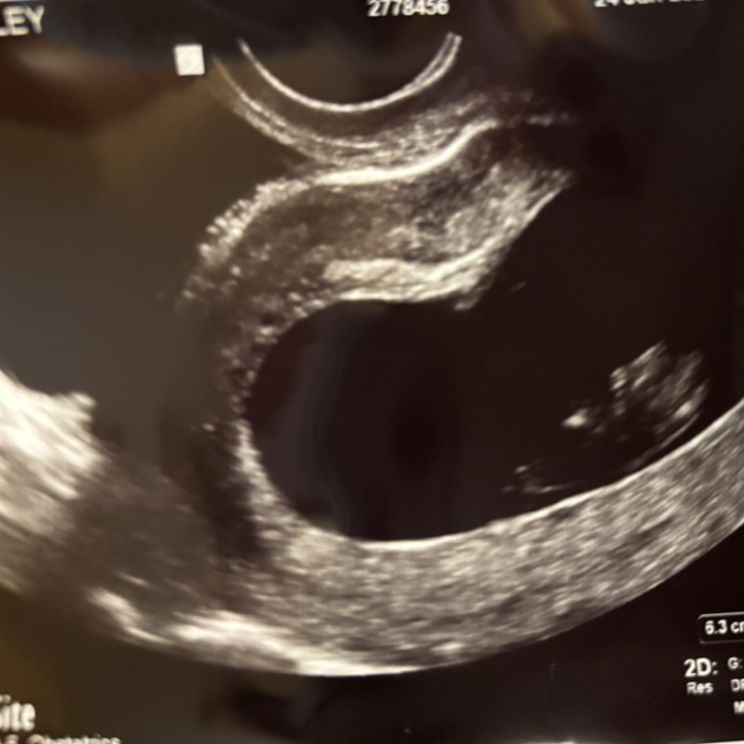 Photo shared by Ashley for their Babylist baby registry.