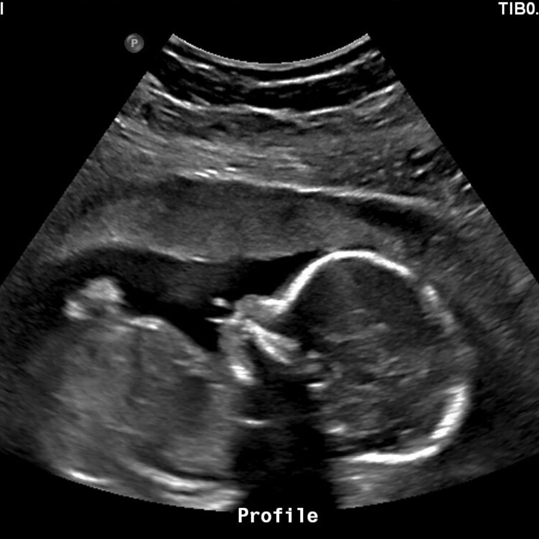 Photo shared by Elexius for their Babylist baby registry.