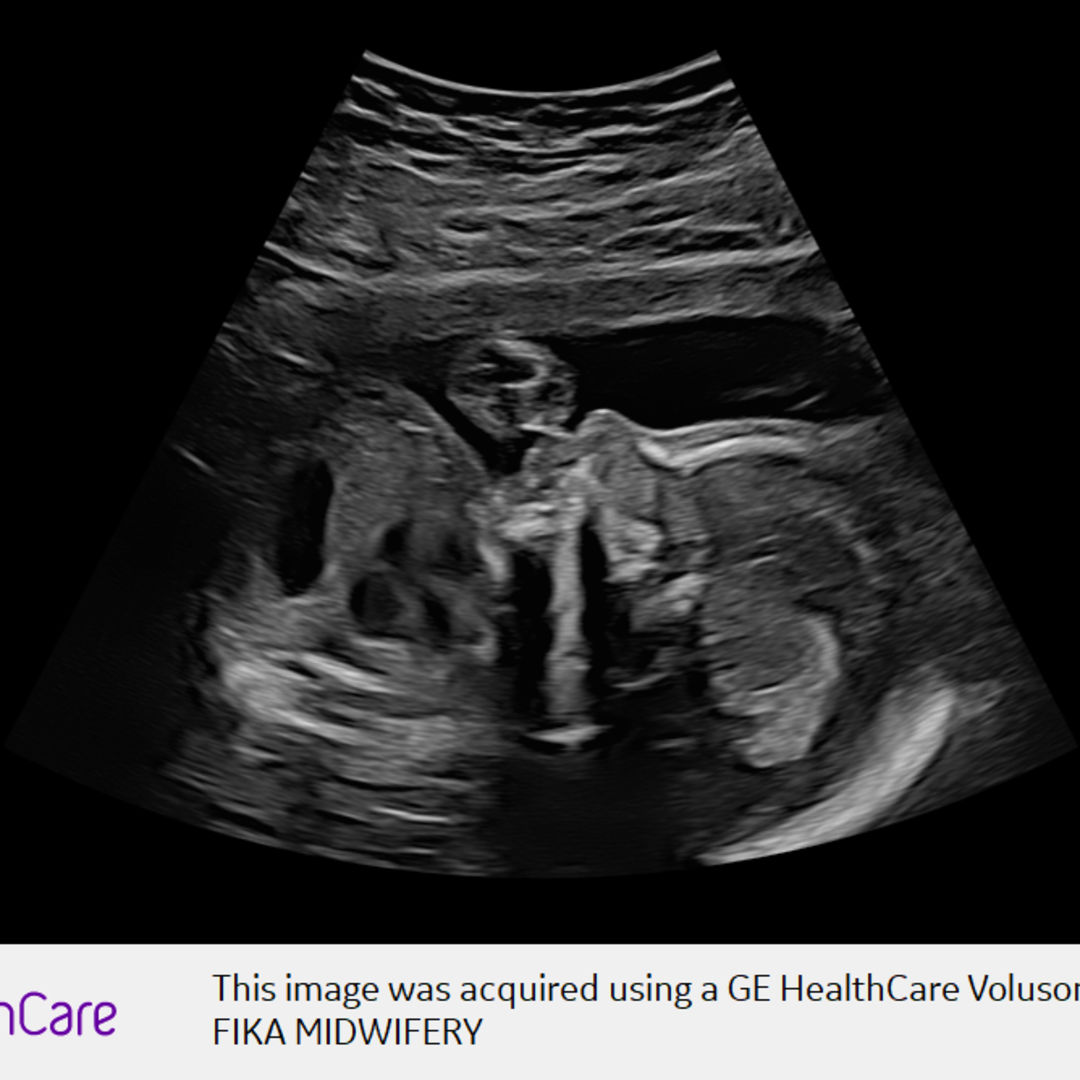 Photo shared by Eliana for their Babylist baby registry.