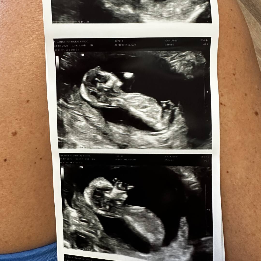 Photo shared by Sarah for their Babylist baby registry.