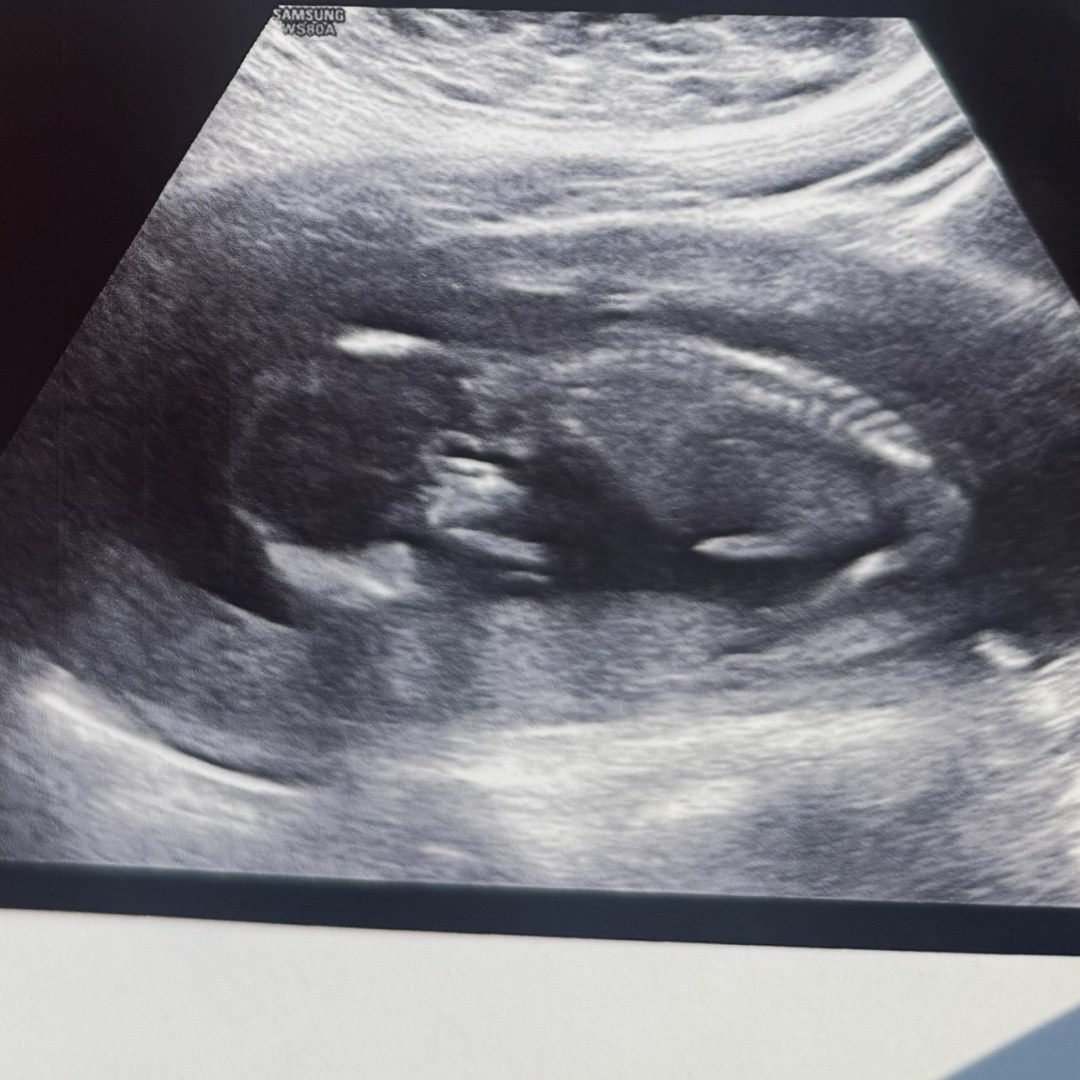 Photo shared by Marissa for their Babylist baby registry.