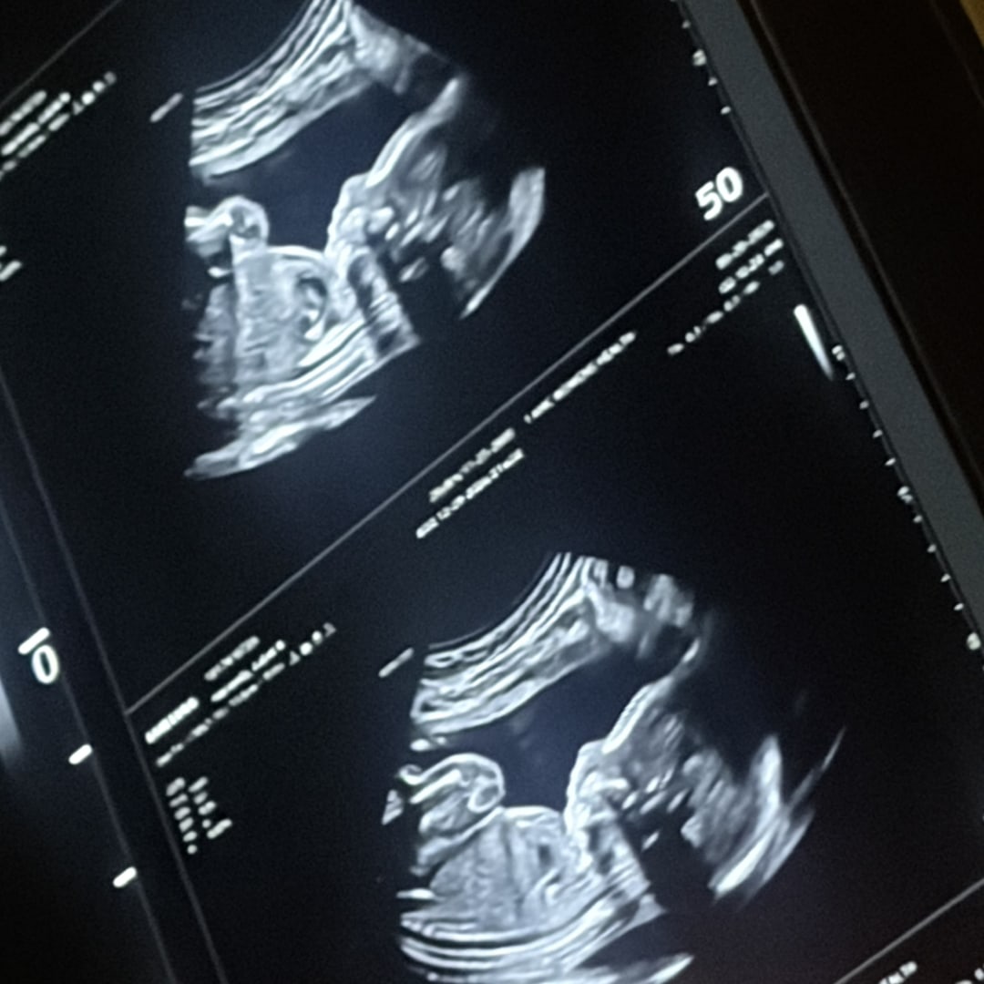 Photo shared by Juliet for their Babylist baby registry.
