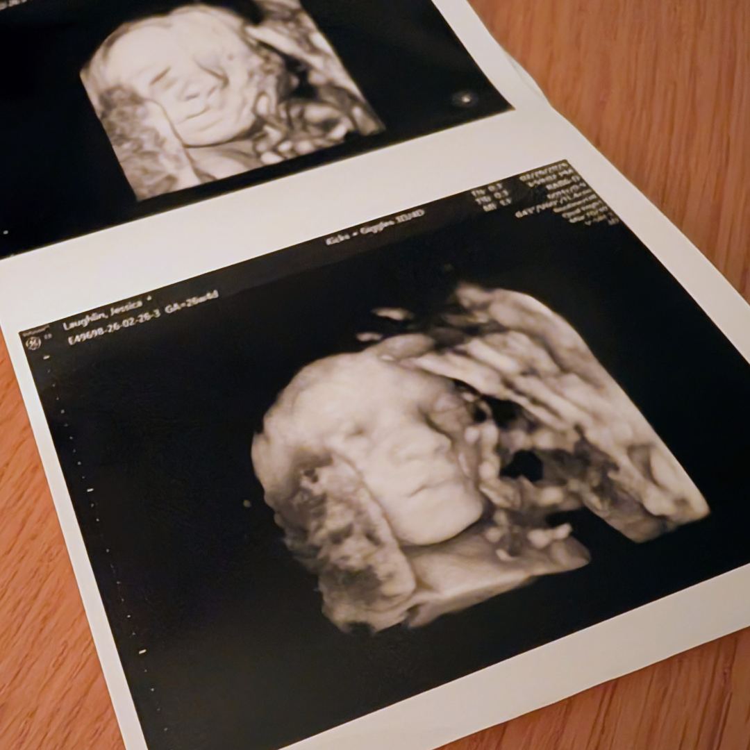 Photo shared by Jess for their Babylist baby registry.