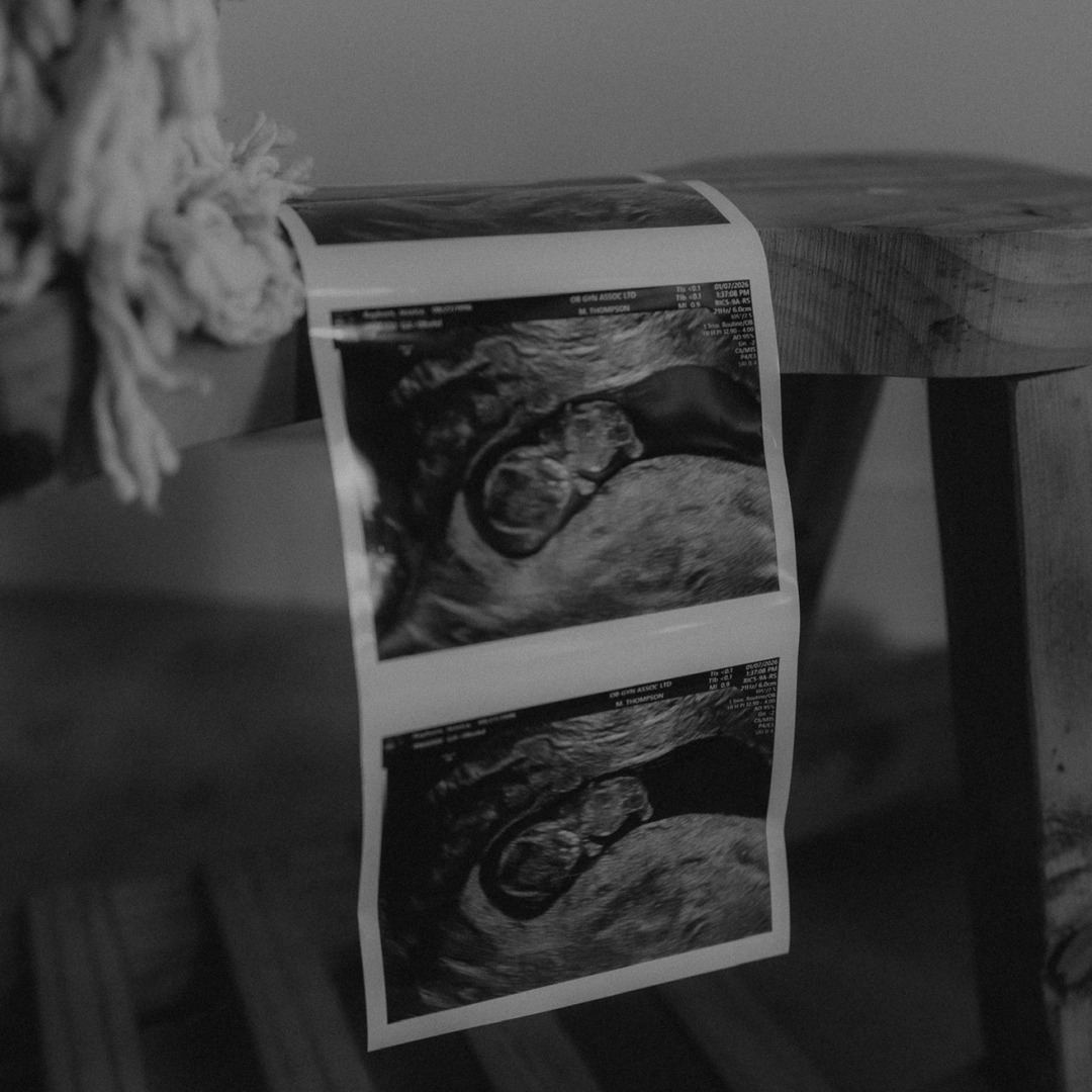 Photo shared by Jessica for their Babylist baby registry.