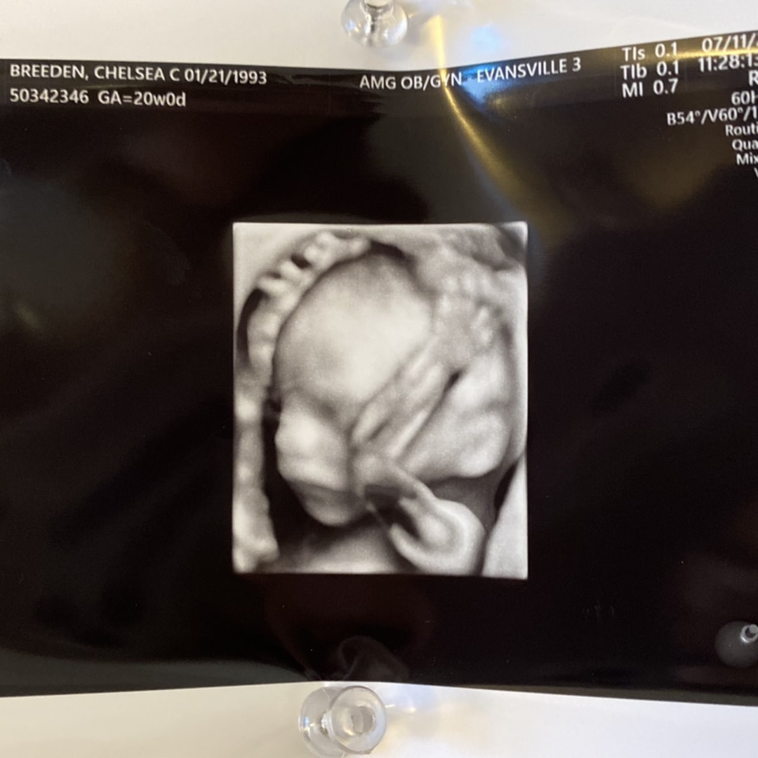 Photo shared by Chelsea for their Babylist baby registry.