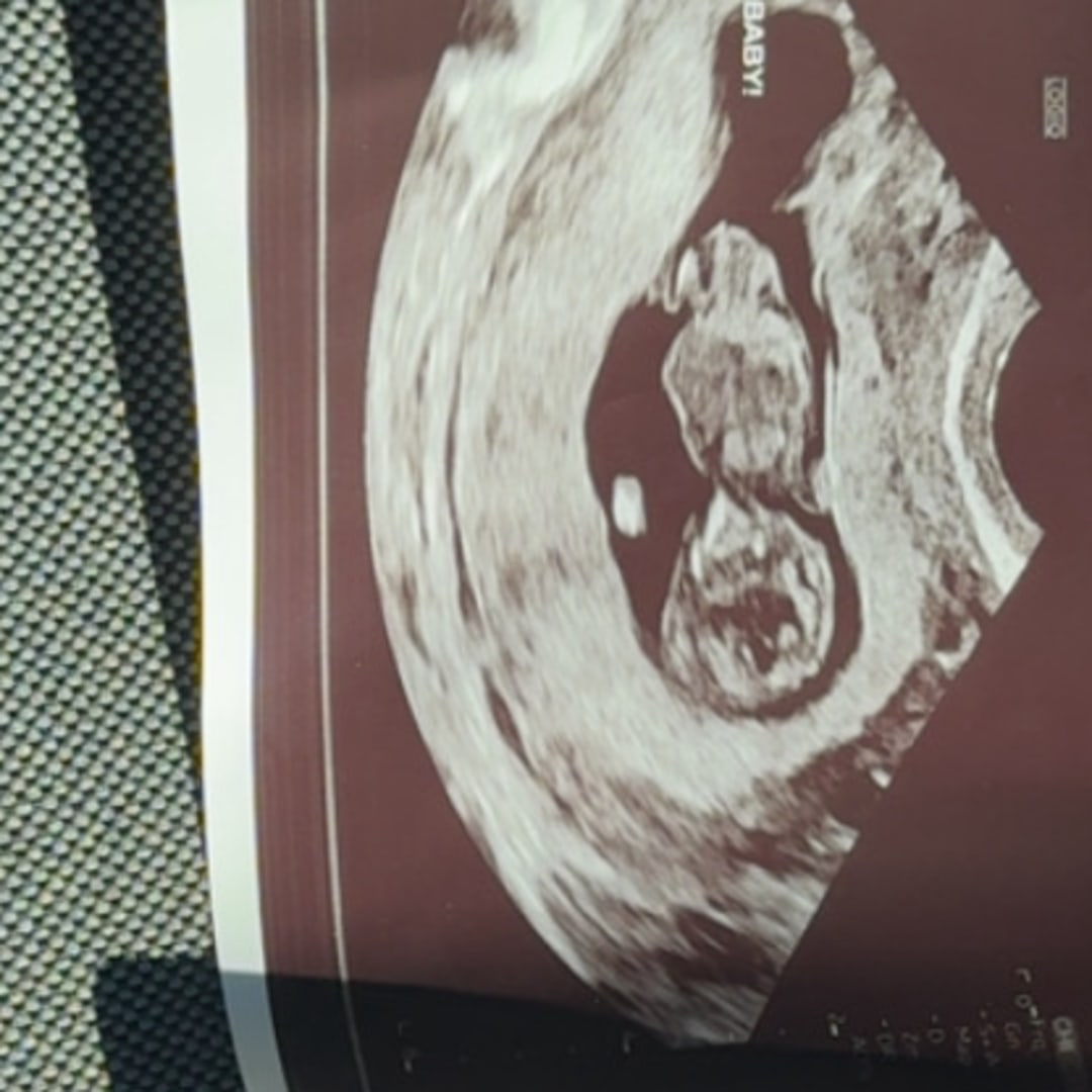 Photo shared by Ashley for their Babylist baby registry.