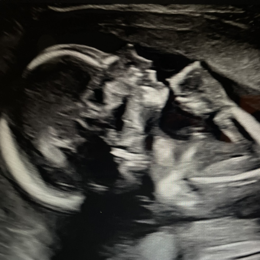 Photo shared by Makenzie for their Babylist baby registry.