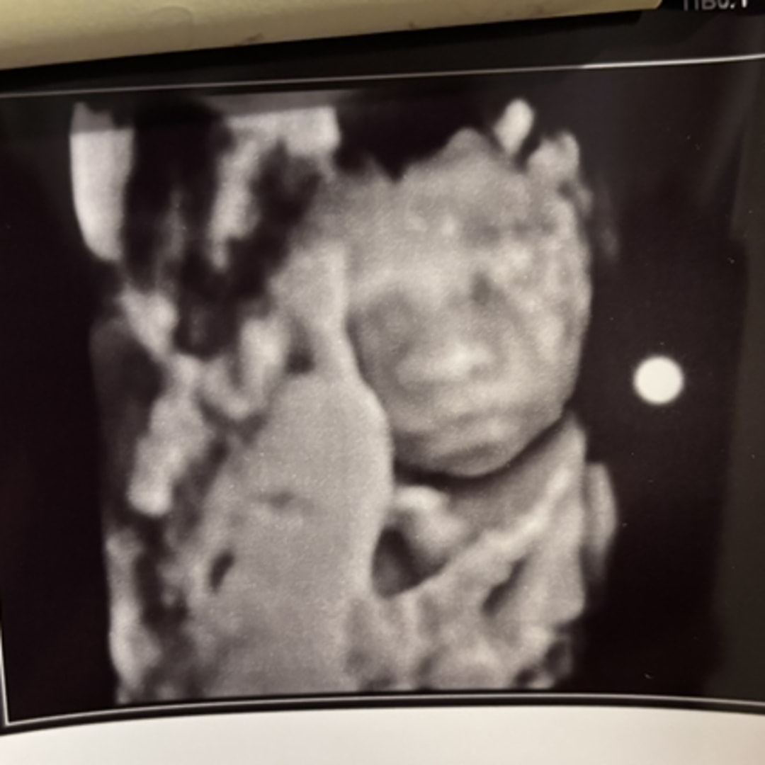 Photo shared by Sadie for their Babylist baby registry.