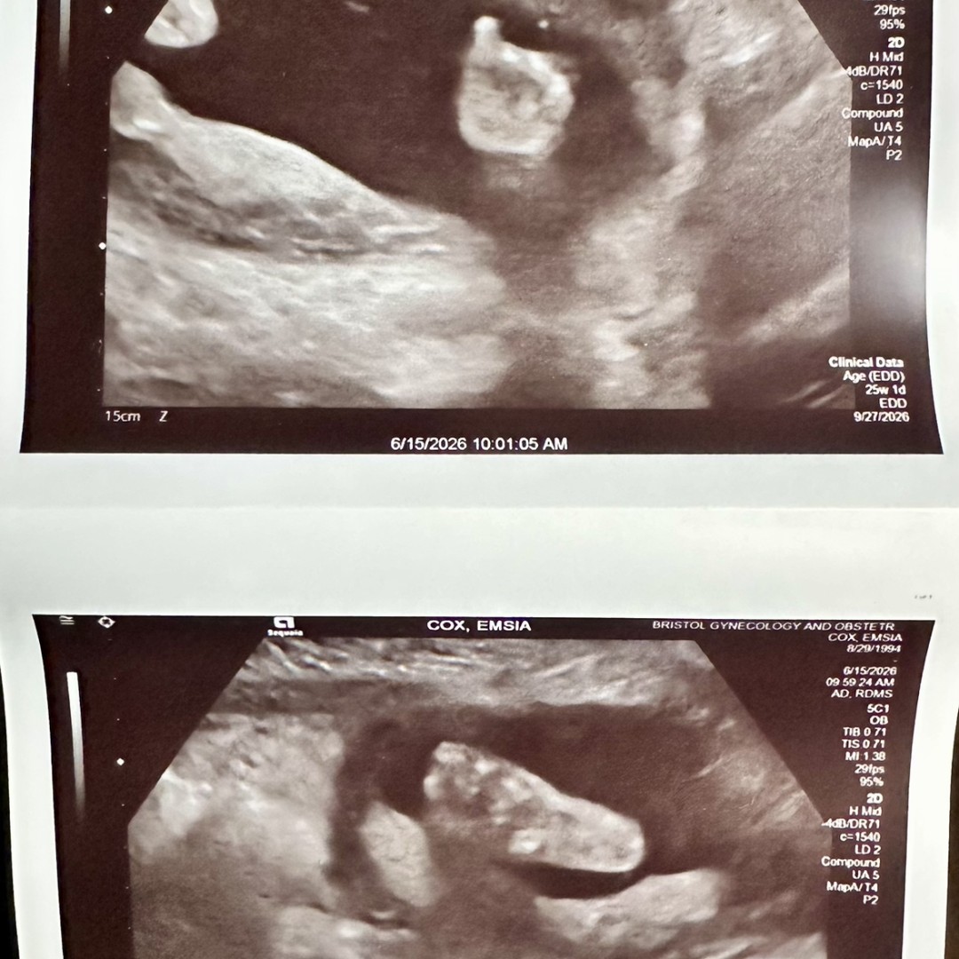 Photo shared by Emsia for their Babylist baby registry.