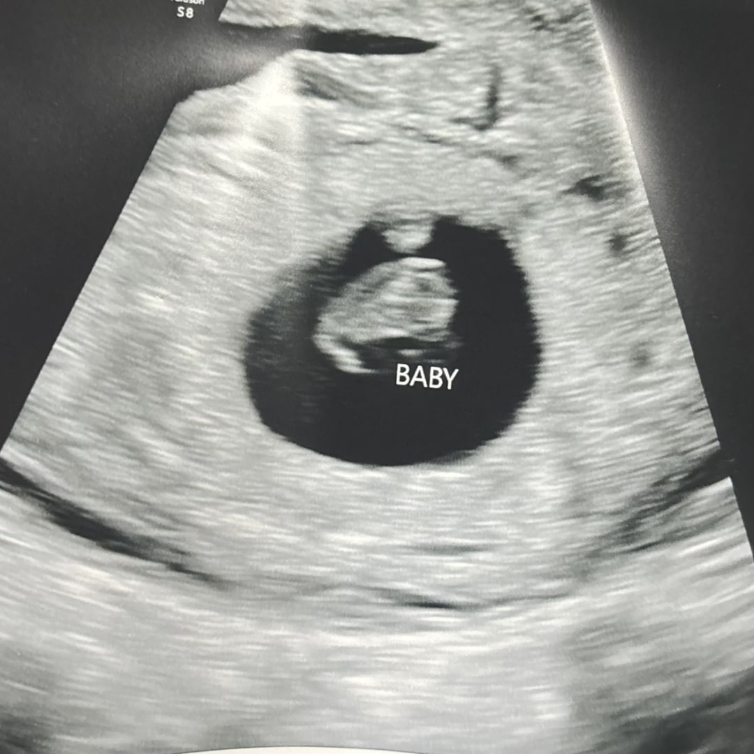 Photo shared by Riley for their Babylist baby registry.