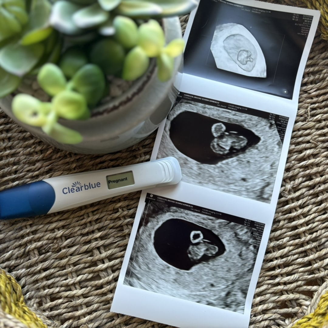 Photo shared by Brooke for their Babylist baby registry.