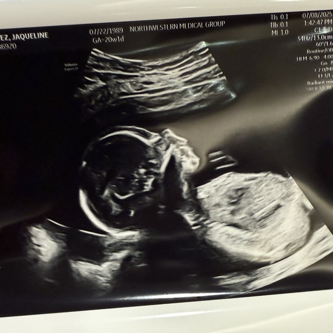 Photo shared by Jackie for their Babylist baby registry.