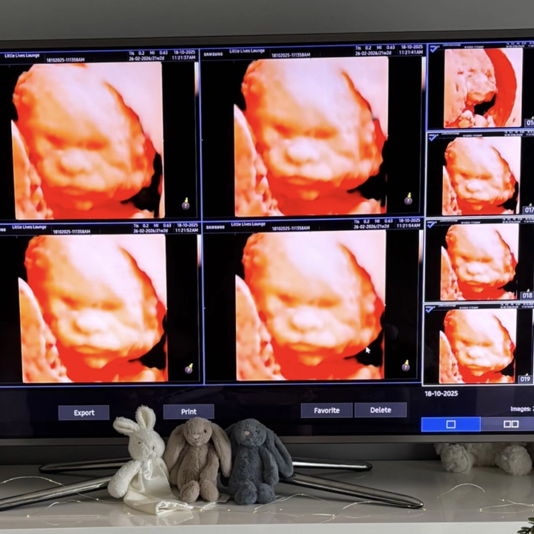 Photo shared by Dakota for their Babylist baby registry.