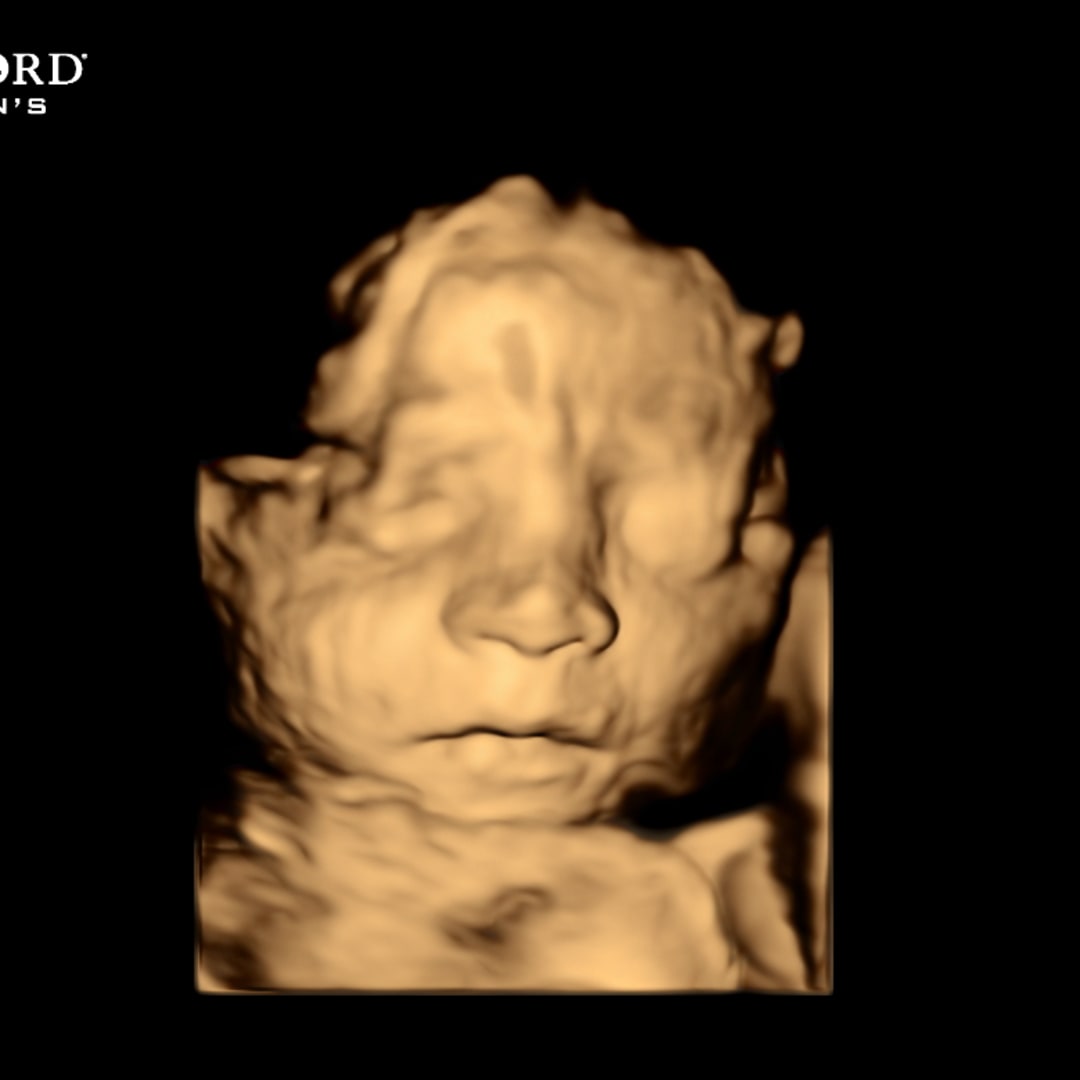 Photo shared by Stephanie for their Babylist baby registry.