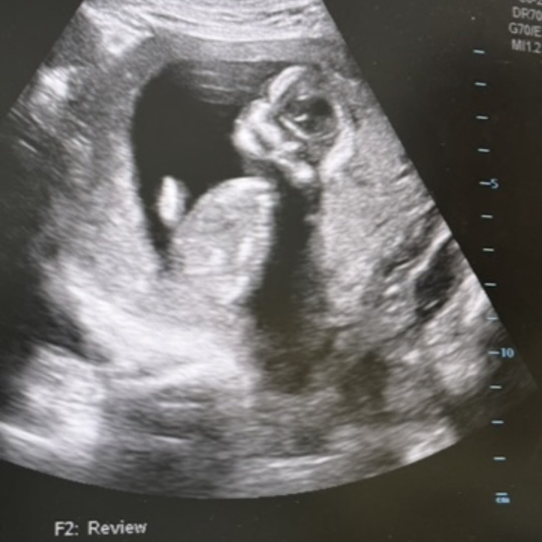 Photo shared by Catherin for their Babylist baby registry.