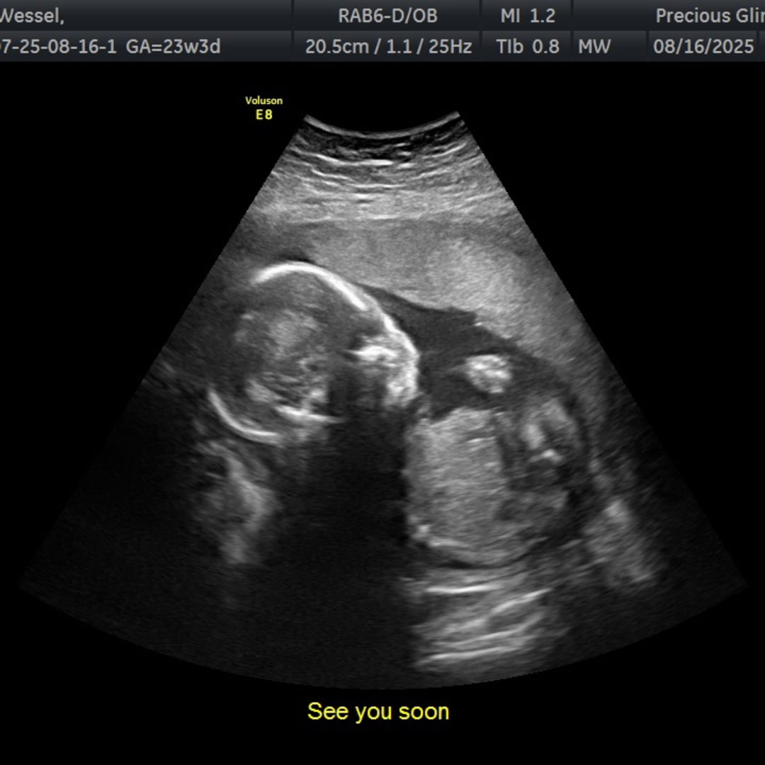 Photo shared by Dacie for their Babylist baby registry.