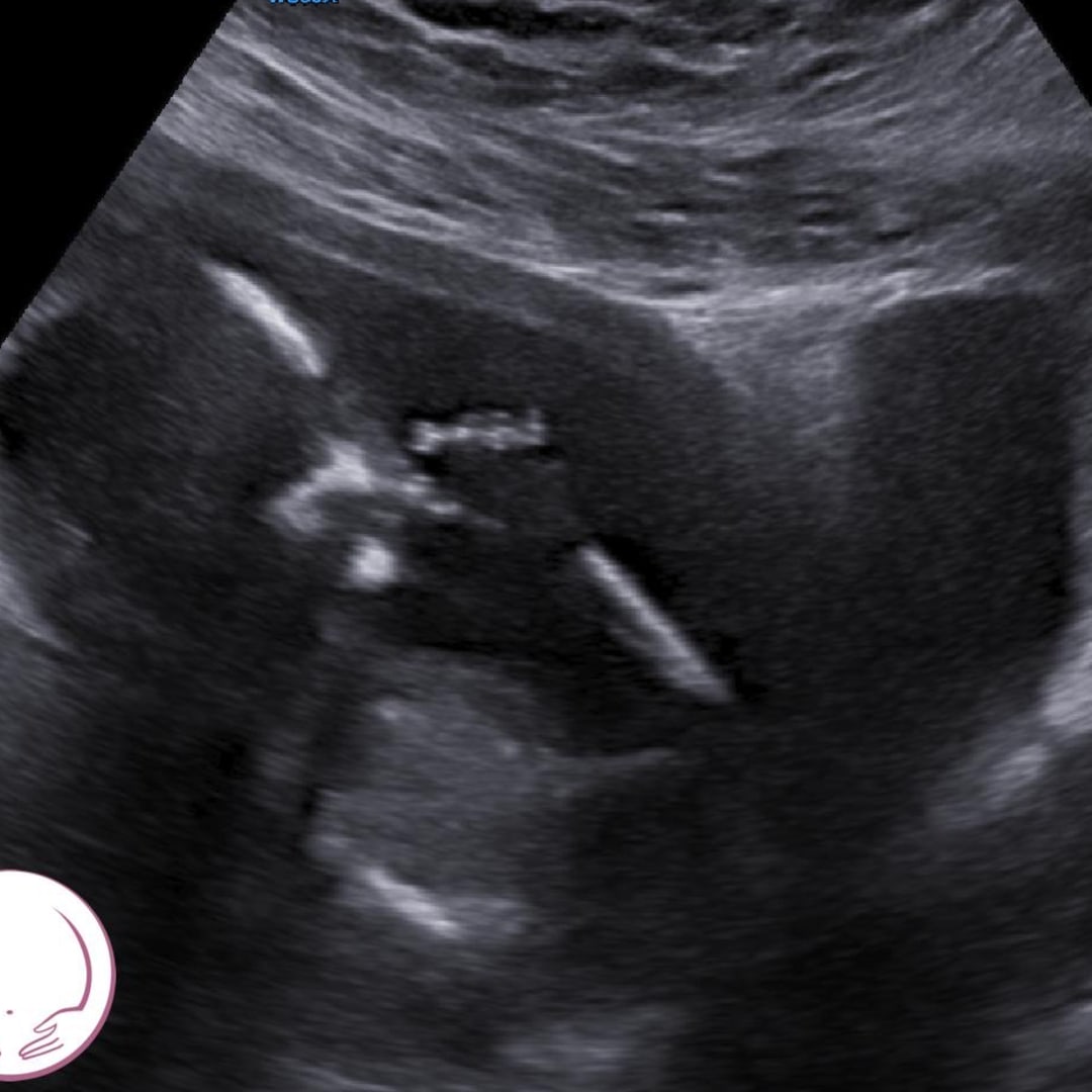 Photo shared by Sarah for their Babylist baby registry.