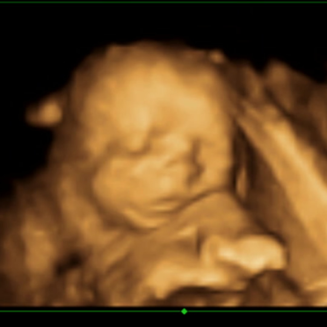 Photo shared by Brinlee for their Babylist baby registry.