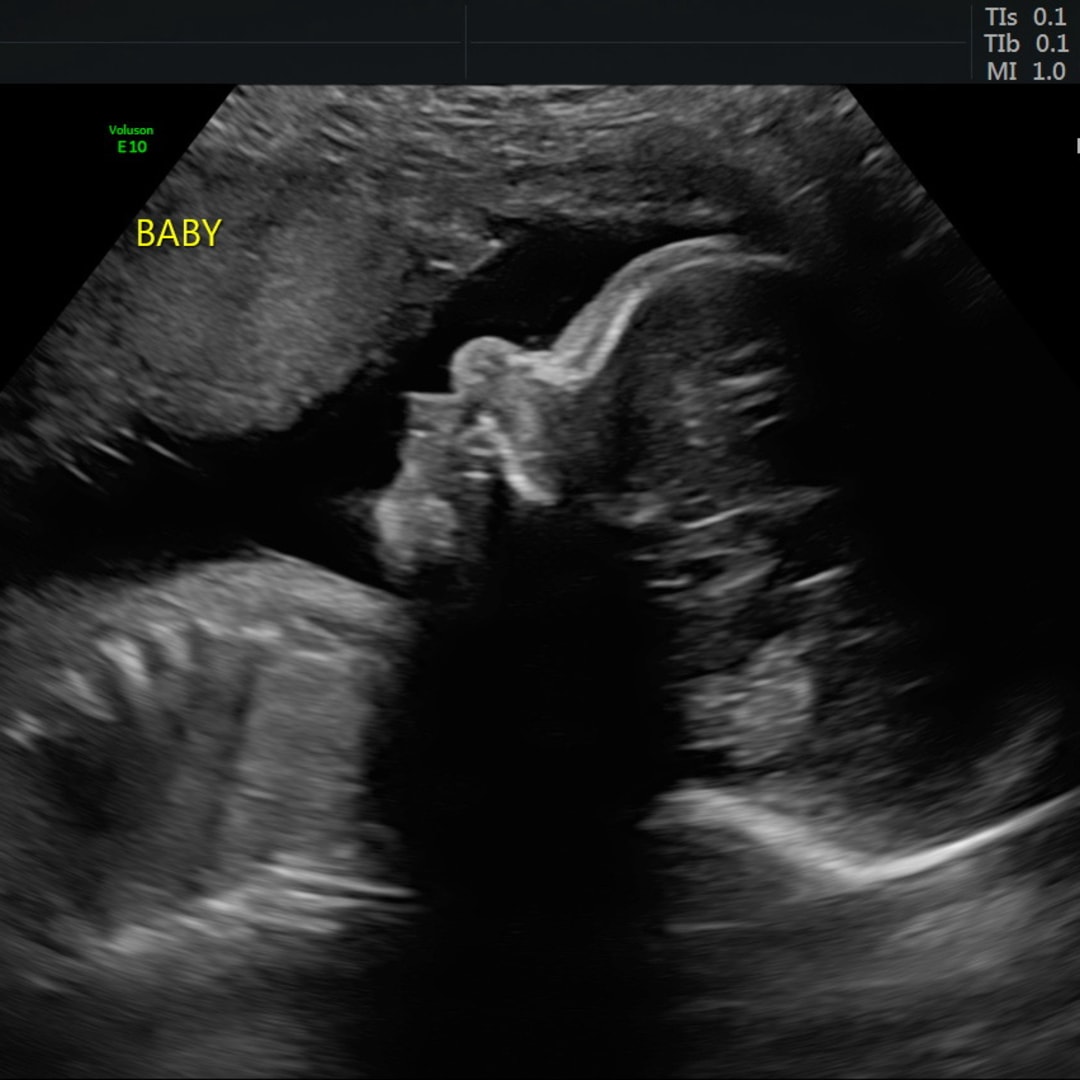 Photo shared by Akeylah for their Babylist baby registry.