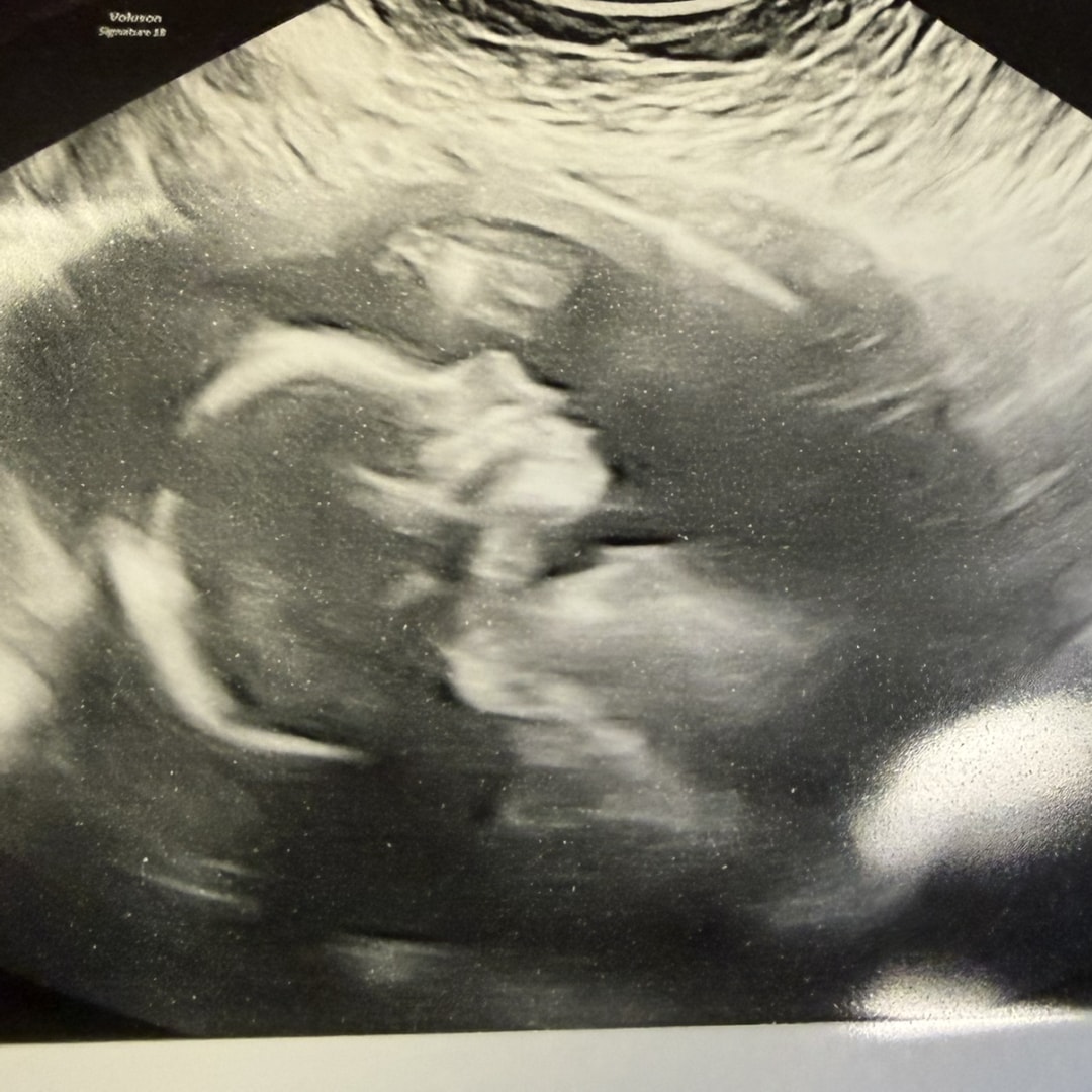 Photo shared by Michelle for their Babylist baby registry.