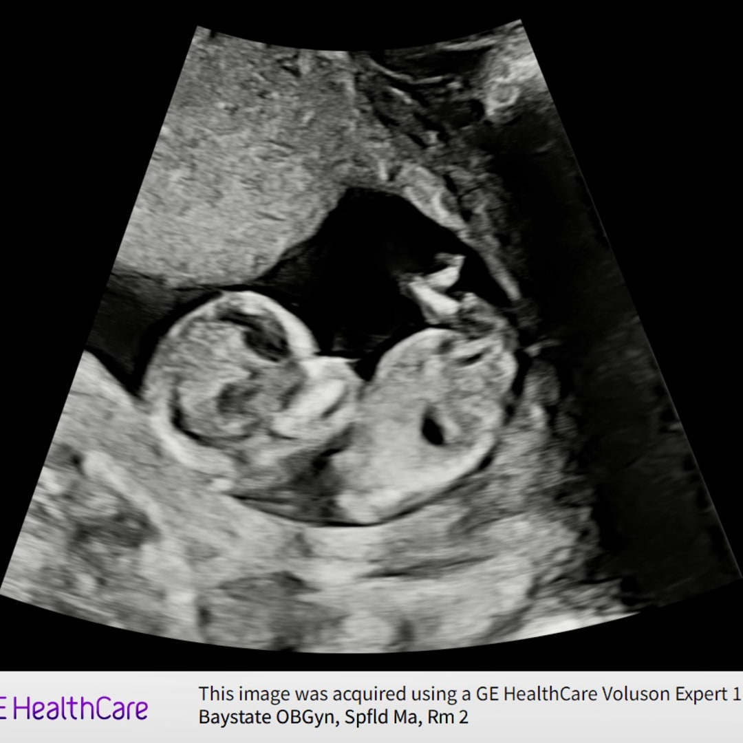 Photo shared by Allison for their Babylist baby registry.