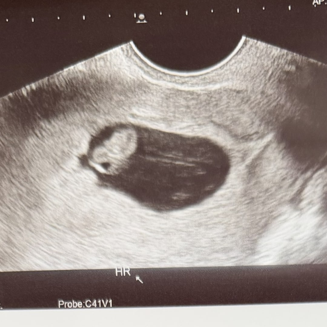 Photo shared by Jasmine for their Babylist baby registry.