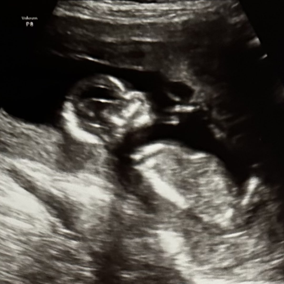 Photo shared by Melody for their Babylist baby registry.