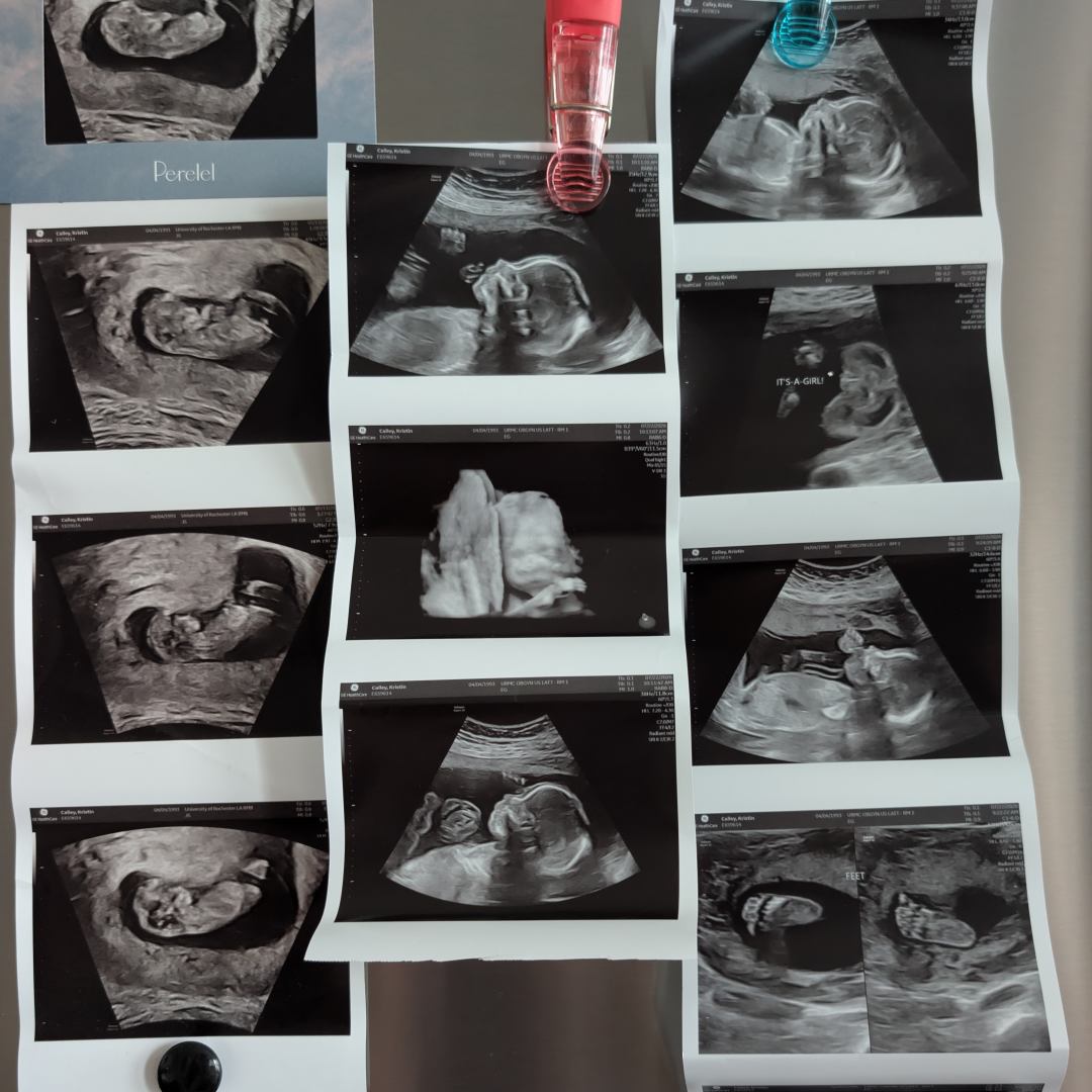 Photo shared by Kristin for their Babylist baby registry.
