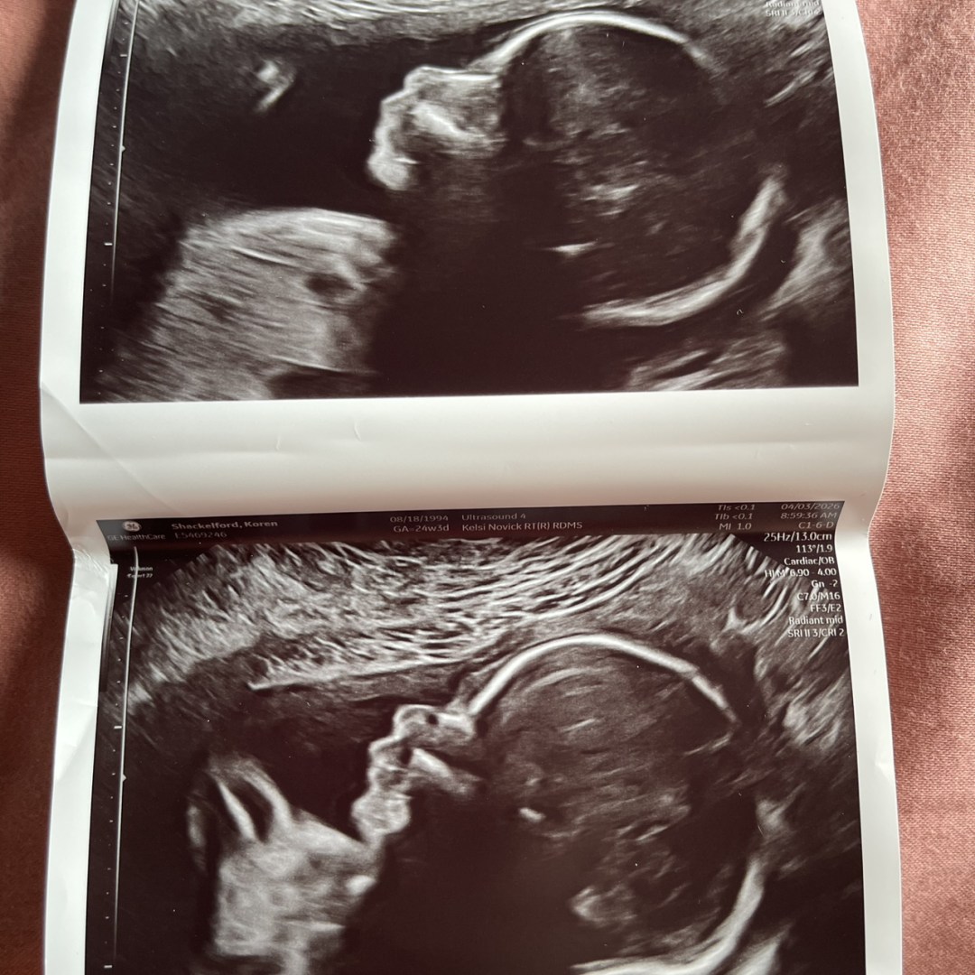 Photo shared by Kory for their Babylist baby registry.