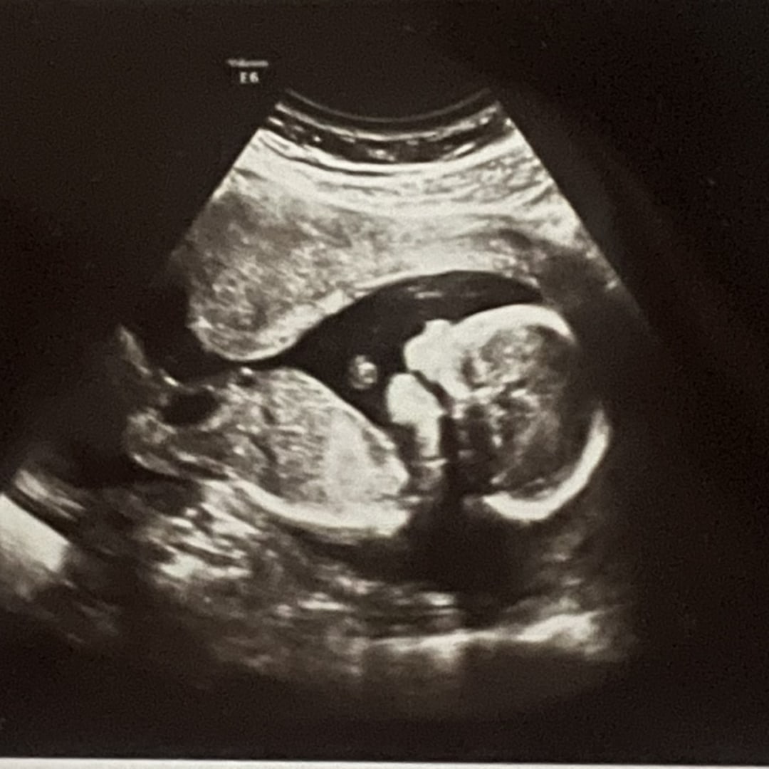 Photo shared by Alizabeth for their Babylist baby registry.