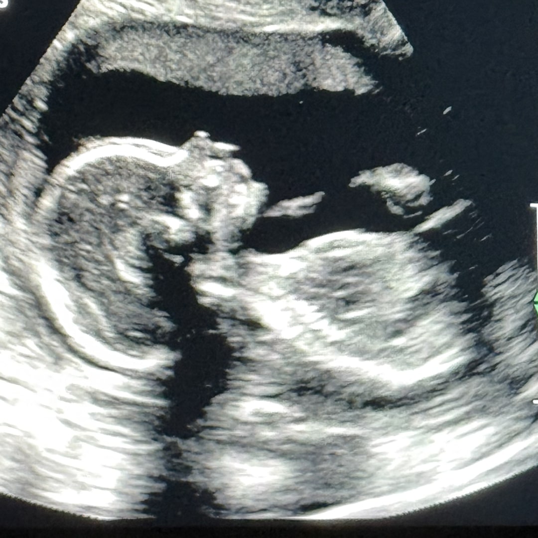 Photo shared by Lauren for their Babylist baby registry.