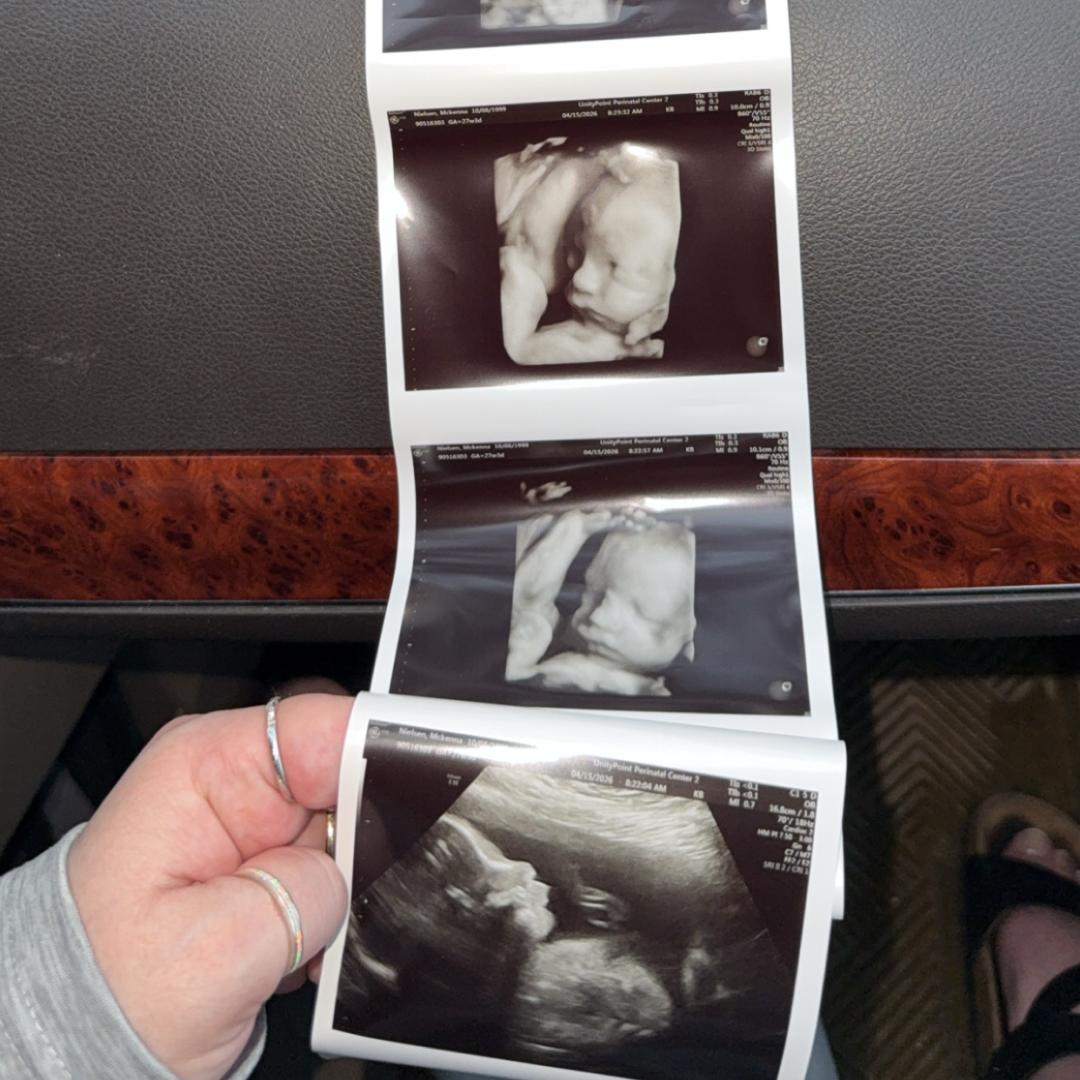 Photo shared by McKenna for their Babylist baby registry.