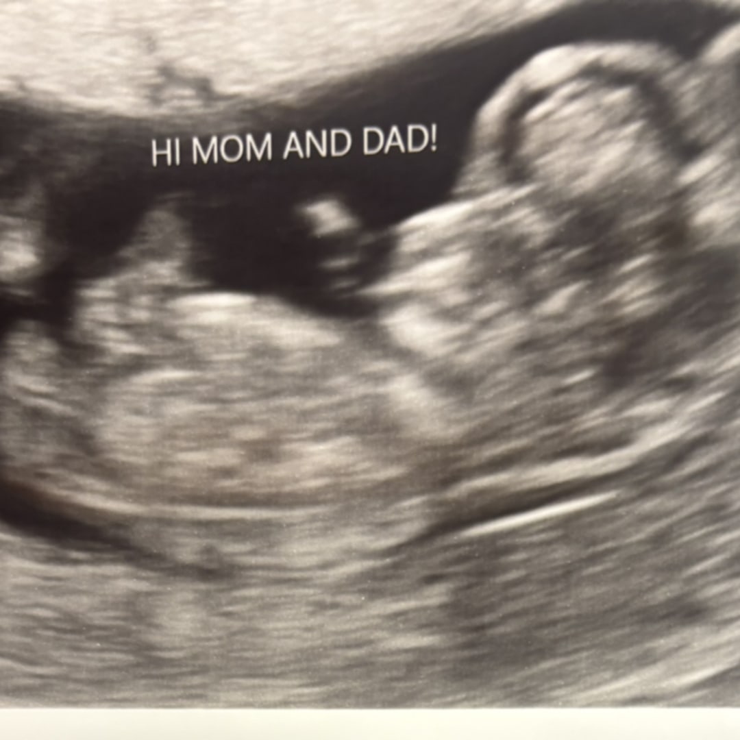 Photo shared by Hailey for their Babylist baby registry.