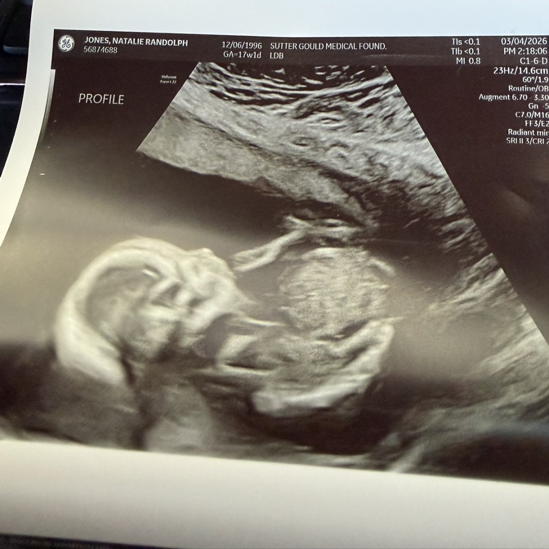 Photo shared by Natalie for their Babylist baby registry.