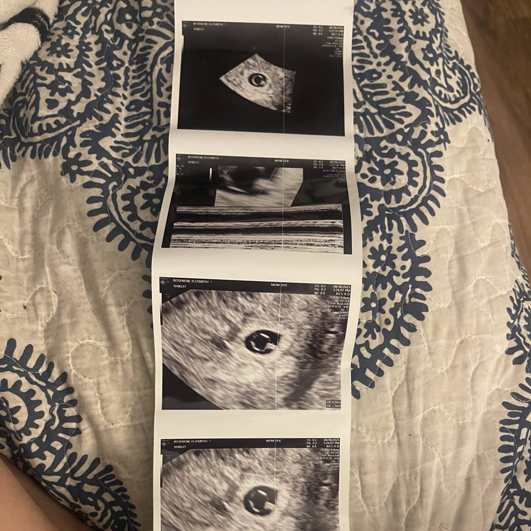 Photo shared by Elizabeth for their Babylist baby registry.